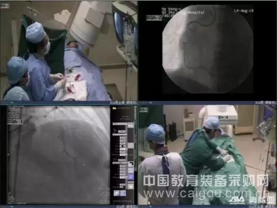CTO名医演绎奥威亚手术示教解决方案