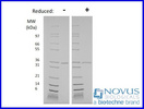 Novus NBP2-76180-500ug Glutamyl endopeptidase 500 ug
